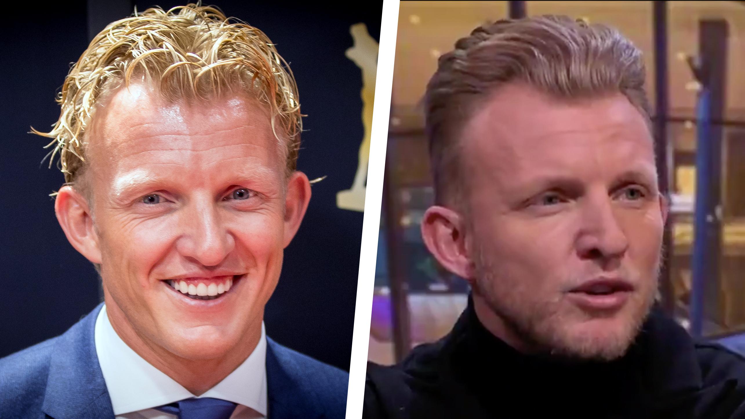 Dirk kuyt plastisch chirurgie